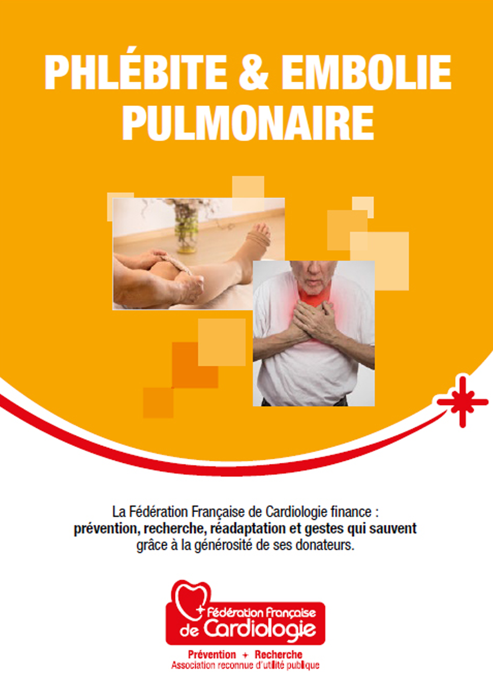 Phlébite et embolie pulmonaire