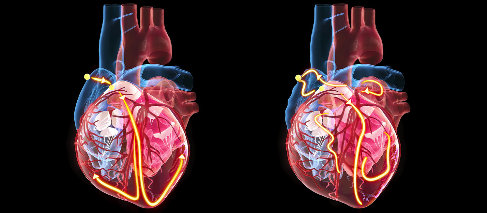 Valve cardiaque : définition, anatomie, rôle