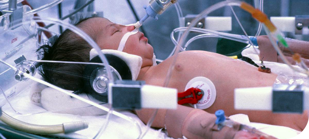 Bébé né avec une malformation passée inaperçue : les échographies